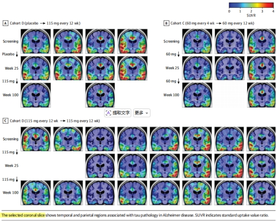 Biib080 Structure 学习笔记:BIIB080的Phase 1b实验数据 & CELIA二期临床数据速览医药新闻-ByDrug-一站式医药资源共享中心-医药魔方