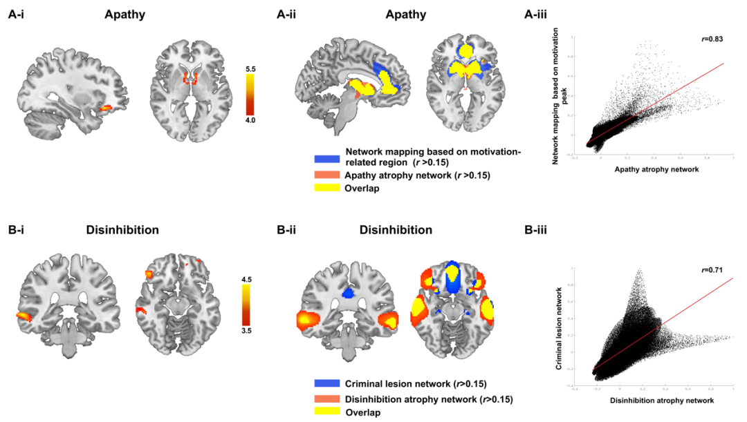 宣武医院武力勇/卢洁教授团队《Brain》提出额颞叶痴呆主要症状网络定位医药新闻-ByDrug-一站式医药资源共享中心-医药魔方