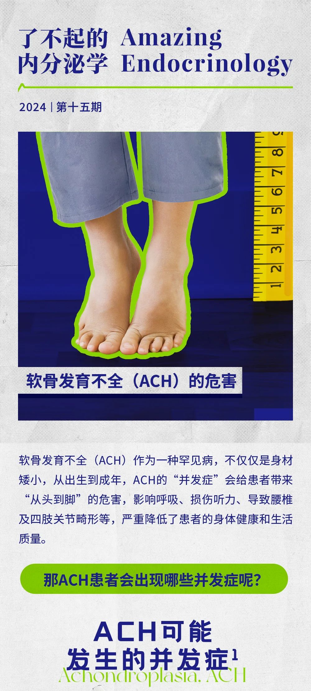 Vol.15 | 软骨发育不全（ACH）的危害医药新闻-ByDrug-一站式医药资源共享中心-医药魔方