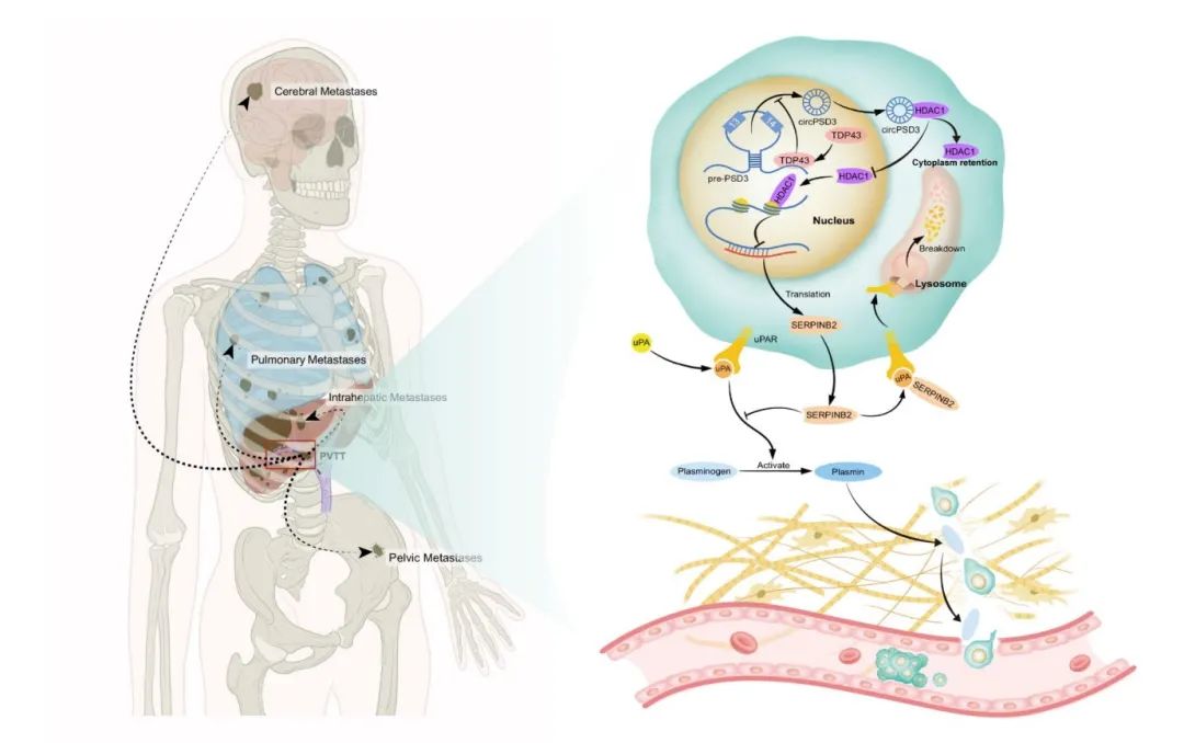 图片[8]-四川大学华西医院发现circPSD3是HCC血管侵袭和转移的重要调节因子-Hypeptide