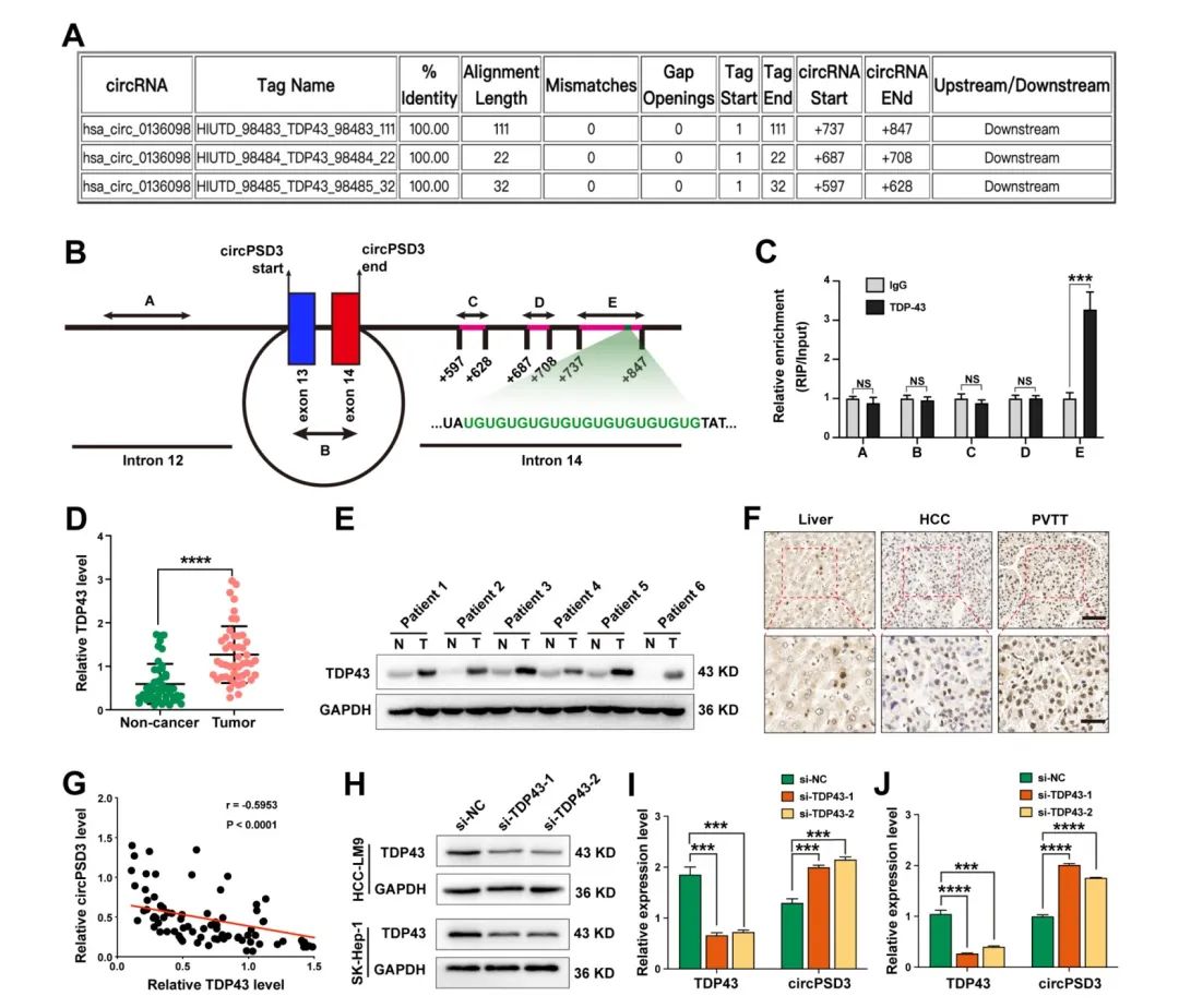 图片[3]-四川大学华西医院发现circPSD3是HCC血管侵袭和转移的重要调节因子-Hypeptide