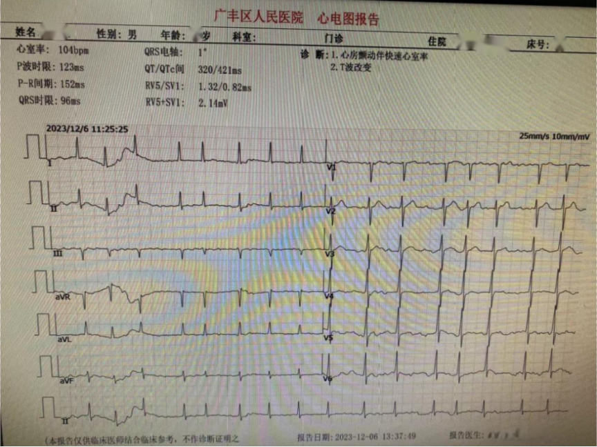 冠心病心电图图片图片