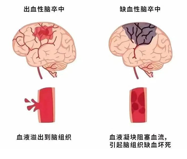 心凯诺:打造血管微创介入平台,积极扬帆出海实现全球布局医药新闻-ByDrug-一站式医药资源共享中心-医药魔方