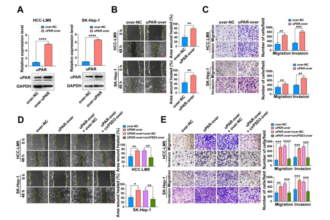 图片[7]-四川大学华西医院发现circPSD3是HCC血管侵袭和转移的重要调节因子-Hypeptide