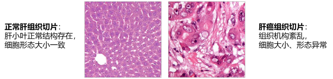 融汇研究 | 诊断“金标准”：病理诊断迎来发展新机遇-Hypeptide