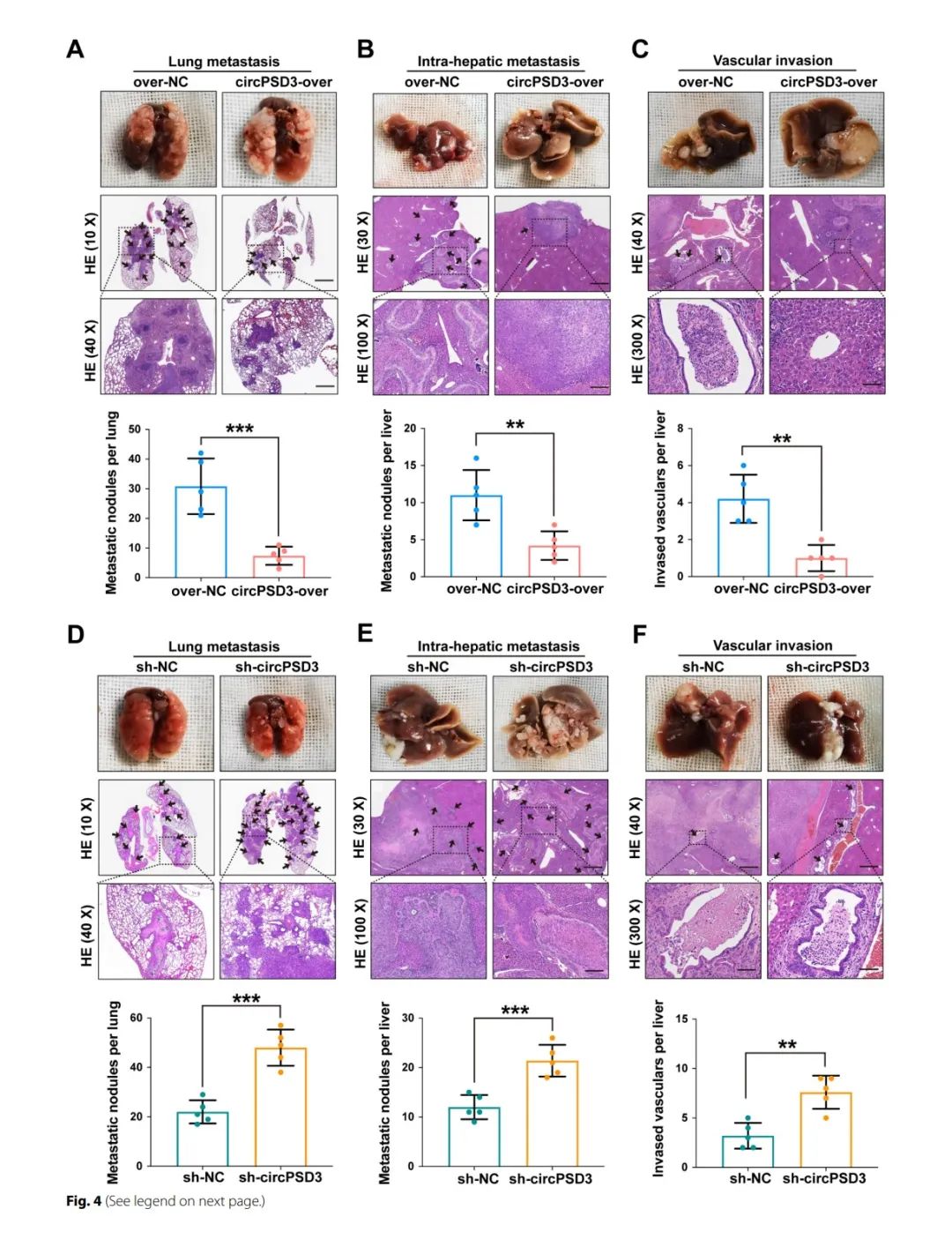 图片[5]-四川大学华西医院发现circPSD3是HCC血管侵袭和转移的重要调节因子-Hypeptide