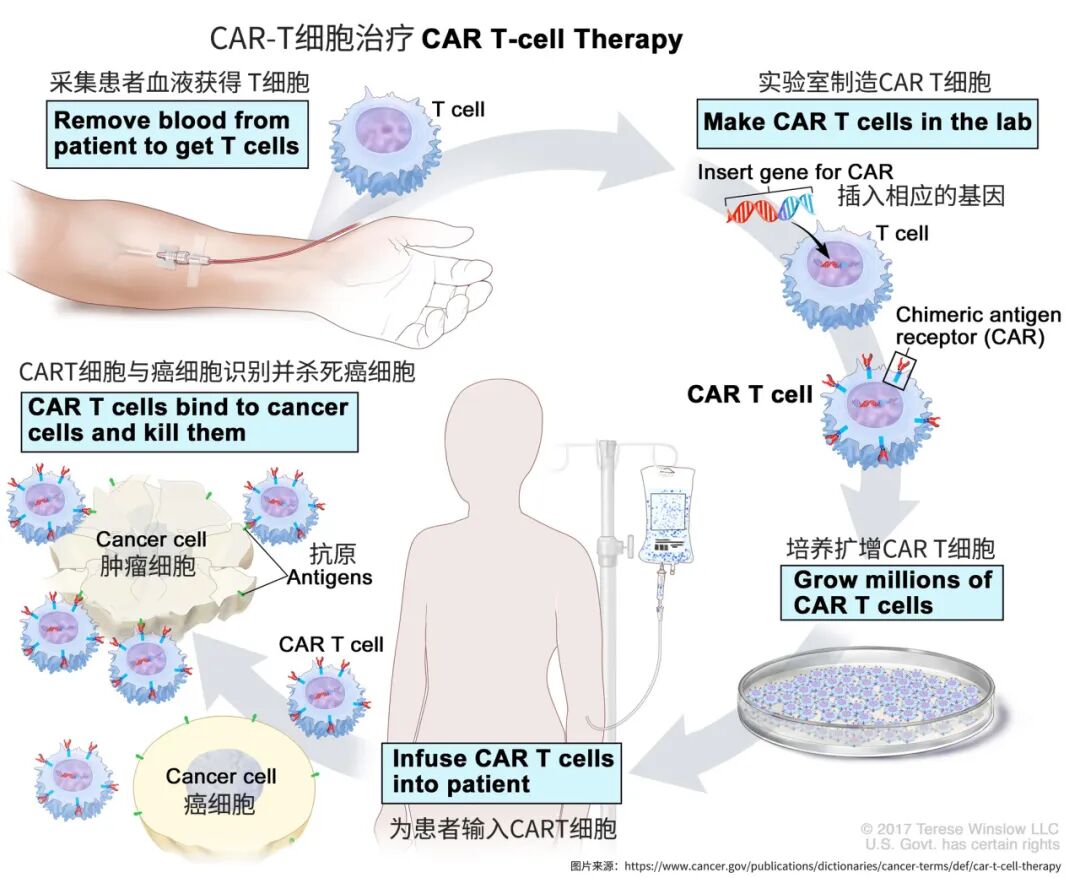 传统CAR-T过时了?不用化疗、只输25万细胞/公斤,体内“波浪式接力”杀癌,完全缓解且不复发!医药新闻-ByDrug-一站式医药资源共享中心 ...
