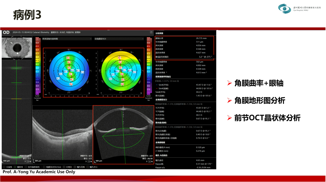 再出颠覆性新品!Intalight赛炜第2代可视化扫频生物测量技术亚太APACRS震撼发布医药新闻-ByDrug-一站式医药资源共享中心-医药魔方
