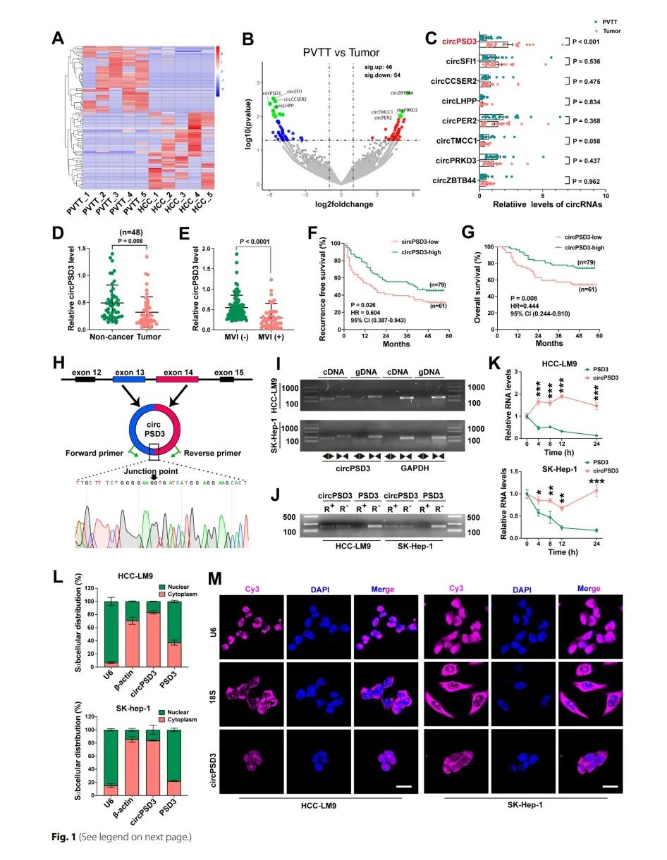 图片[2]-四川大学华西医院发现circPSD3是HCC血管侵袭和转移的重要调节因子-Hypeptide