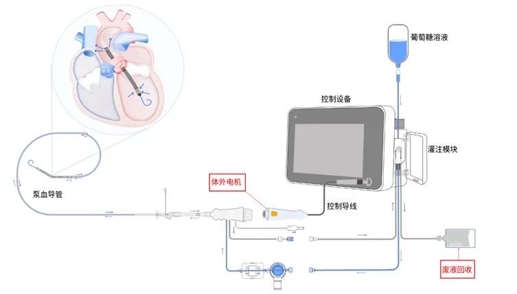 心脏里的中国力量:唐智荣的“心”产品,正在登顶全球之巅医药新闻-ByDrug-一站式医药资源共享中心-医药魔方