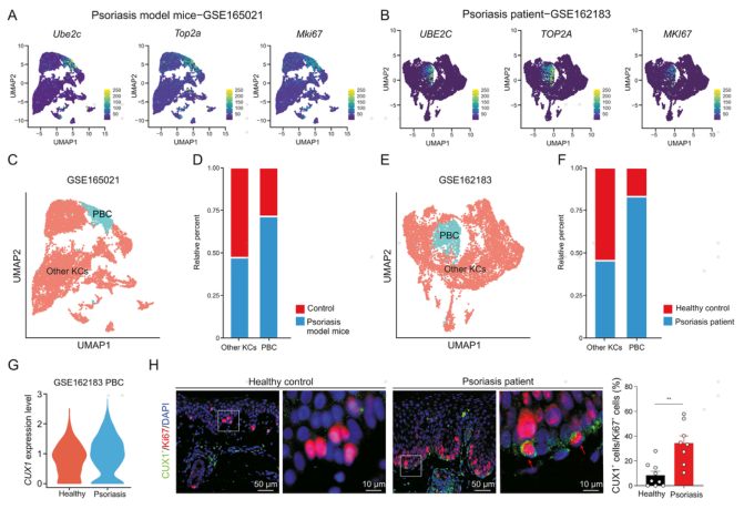 图片[8]-项目文章 | 慢性干皮病细胞图谱中一种新型基底细胞状态及其功能-Hypeptide