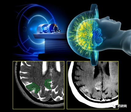 新突破！靶向药物递送治疗阿尔茨海默病-Hypeptide