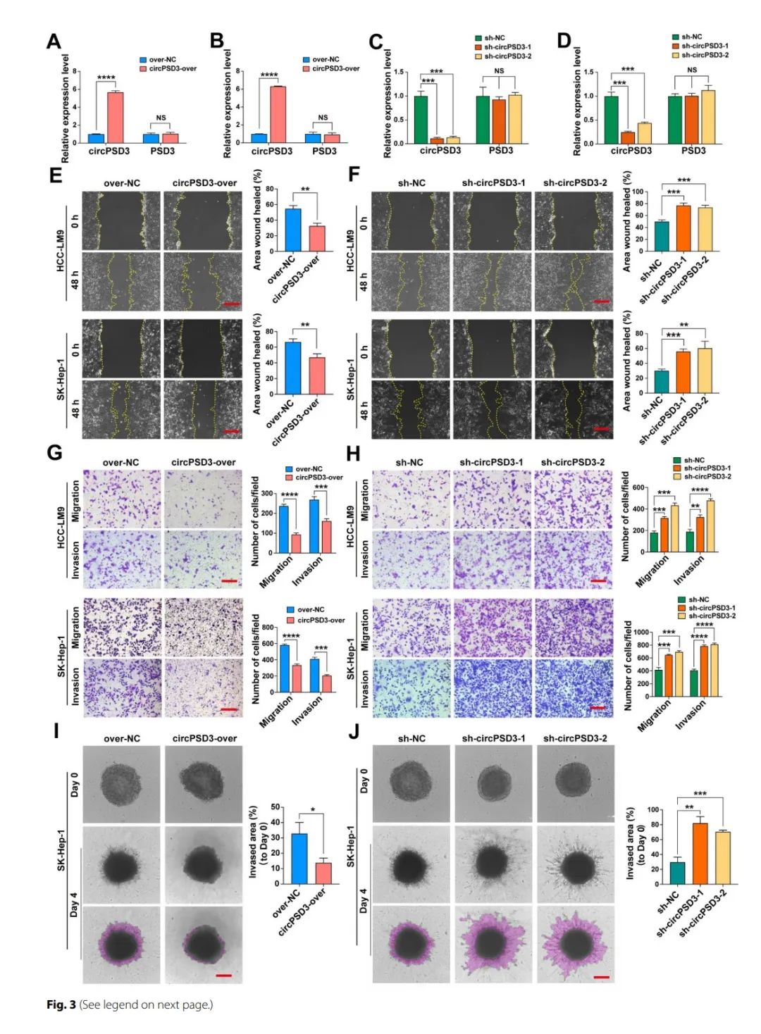 图片[4]-四川大学华西医院发现circPSD3是HCC血管侵袭和转移的重要调节因子-Hypeptide