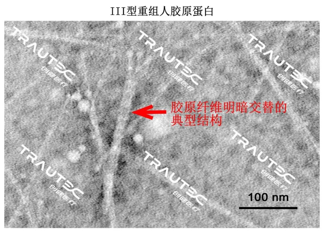 创健医疗成功研发III型重组人胶原蛋白,同时具备全长氨基酸序列和三螺旋结构,可实现产业化医药新闻-ByDrug-一站式医药资源共享中心-医药魔方